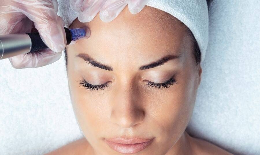 dermapen